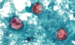Cyclospora cayetanensis